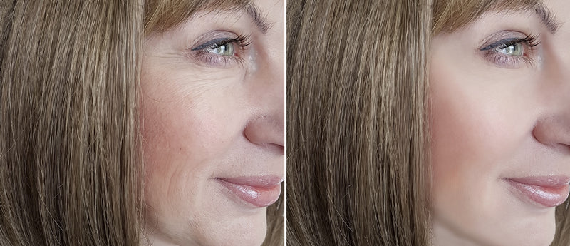 Mature women Before and After Results